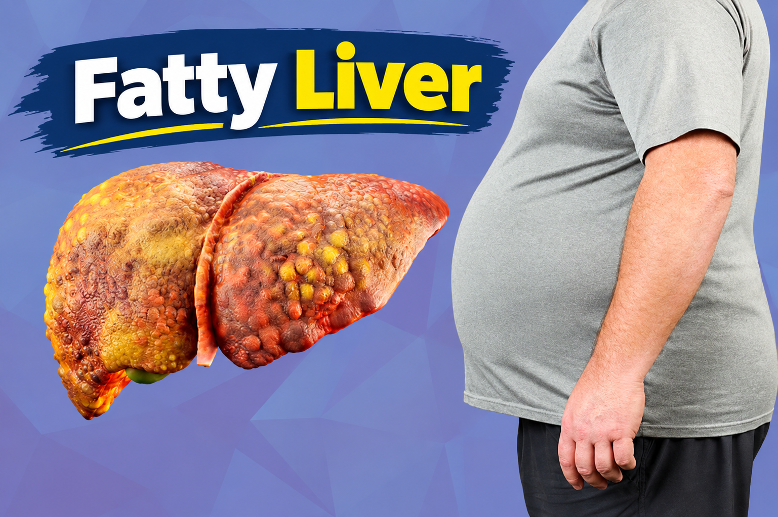 Fatty Liver