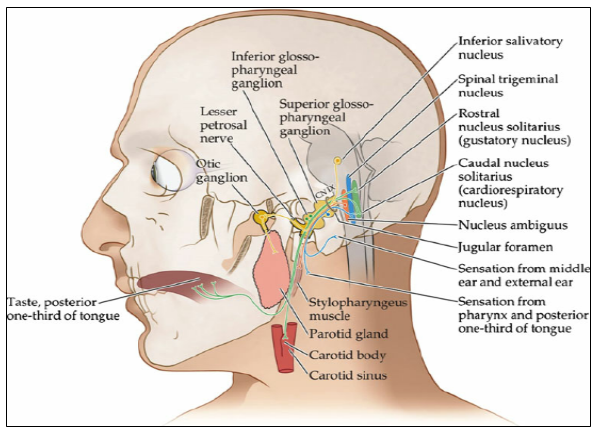 Natural Tratment for Glossopharyngeal Neuralgia