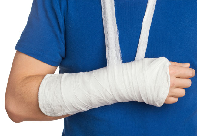 Colles fracture Colles fracture