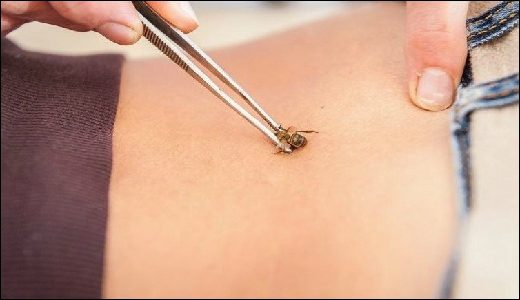 Apitherapy Apitherapy