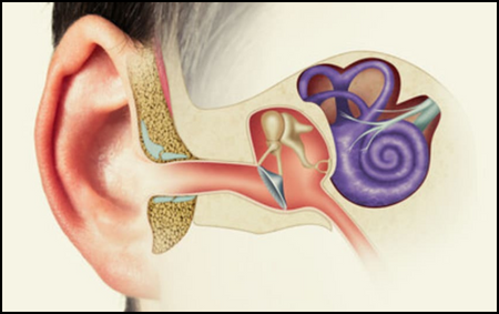 Vestibular Hypofunction Vestibular Hypofunction