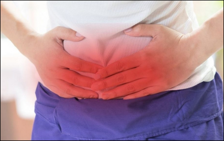 Femoral hernia Femoral Hernia