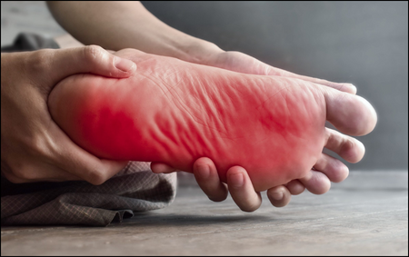 Diabetic Neuropathy Diabetic Neuropathy