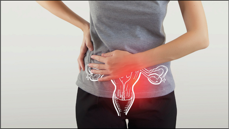 Polycystic Ovarian Disease (PCOD)