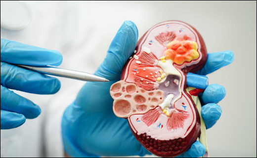 Chronic Kidney Disease